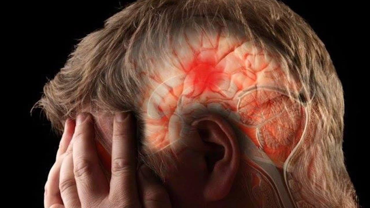 Qué enfermedades se pueden detectar con un tac cerebral